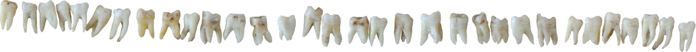 a divider designed to look like a row of teeth
